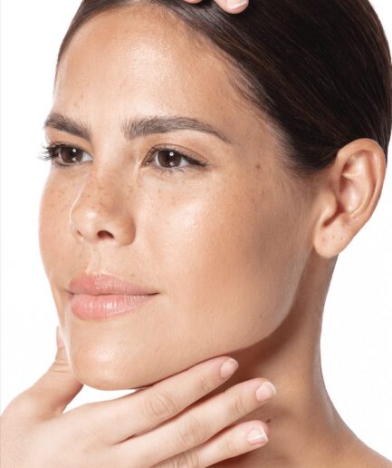 Tratamiento de rejuvenecimiento facial sin cirugía Supra Facial