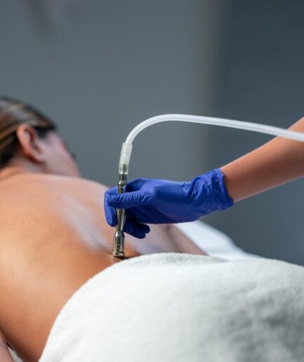 Tratamiento de Microdermoabrasión de Espalda en Puerto Rico