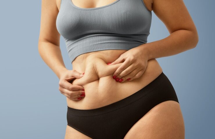 mujer buscando tratamientos para eliminar flacidez abdominal sin cirugía