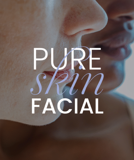 foto de pieles mujer blanca y mujer negra, pure skin facial